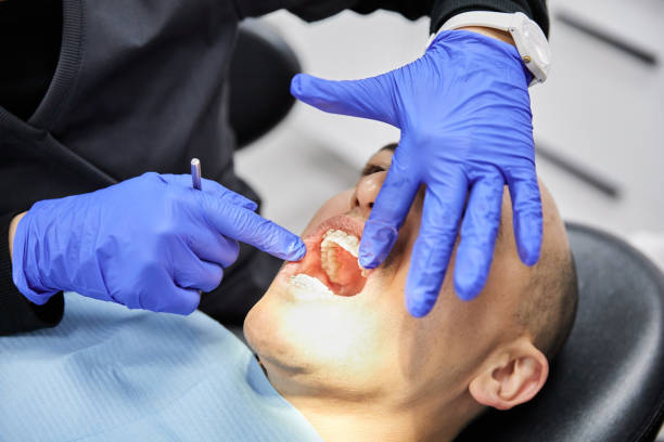 Best Emergency Dental Care for Sports Injuries in Lubeck, WV